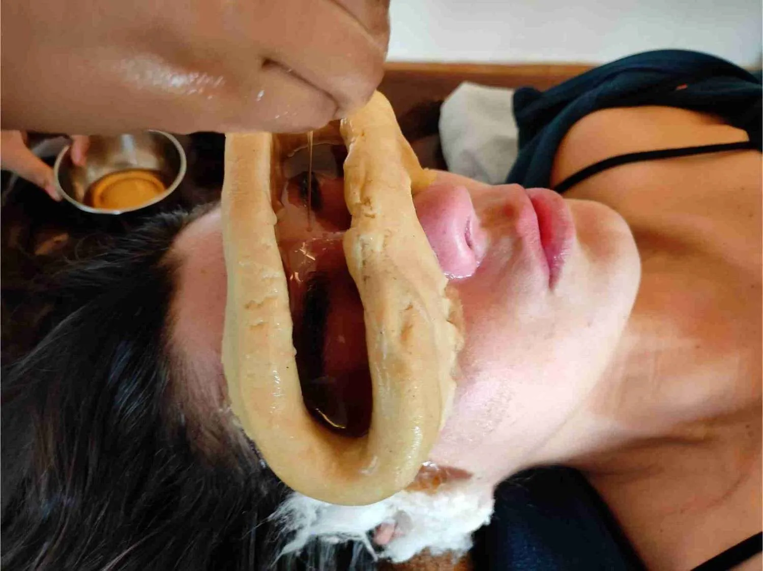 Him Veda Treatment